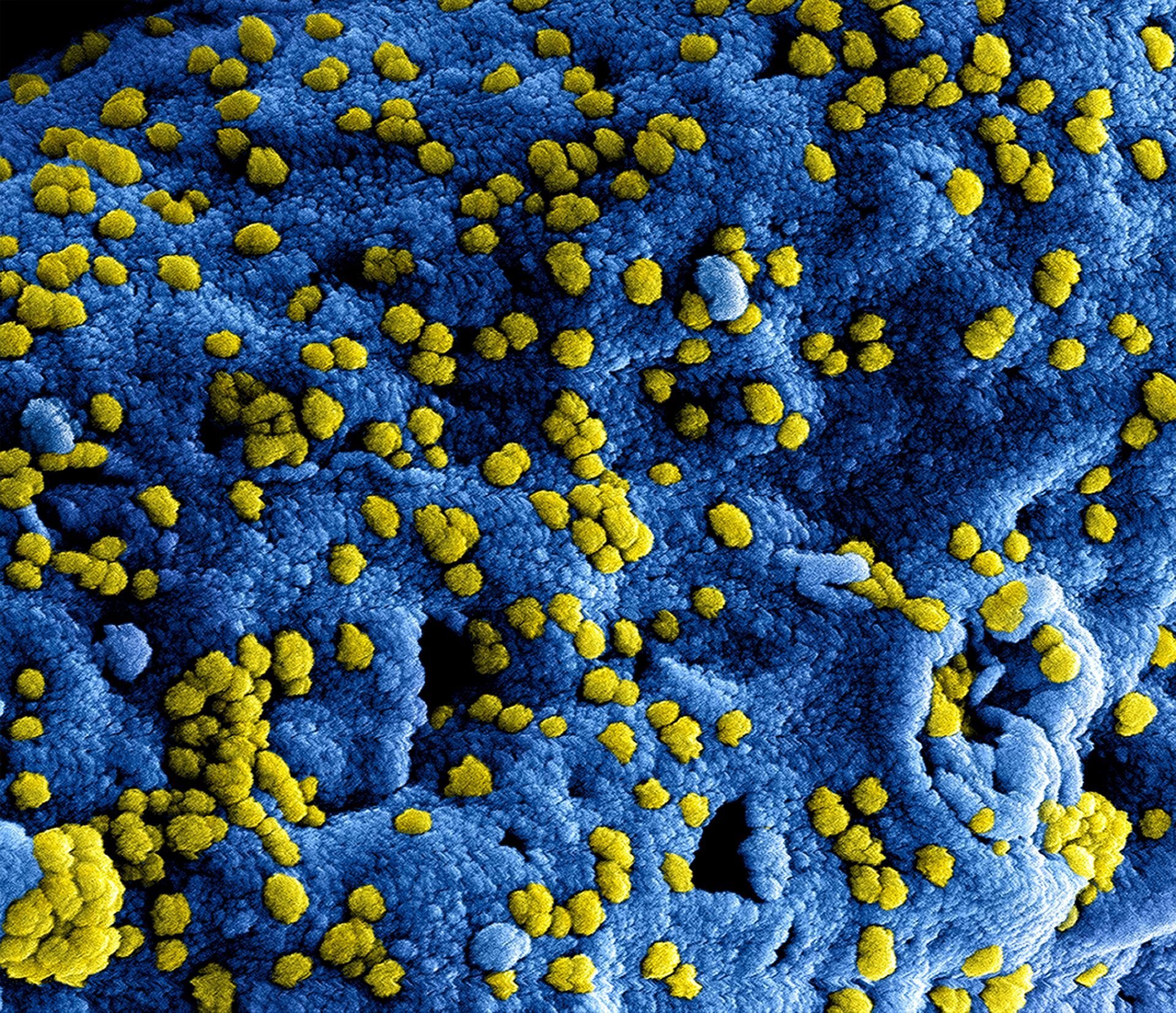 Vírus do ebola em microscópio